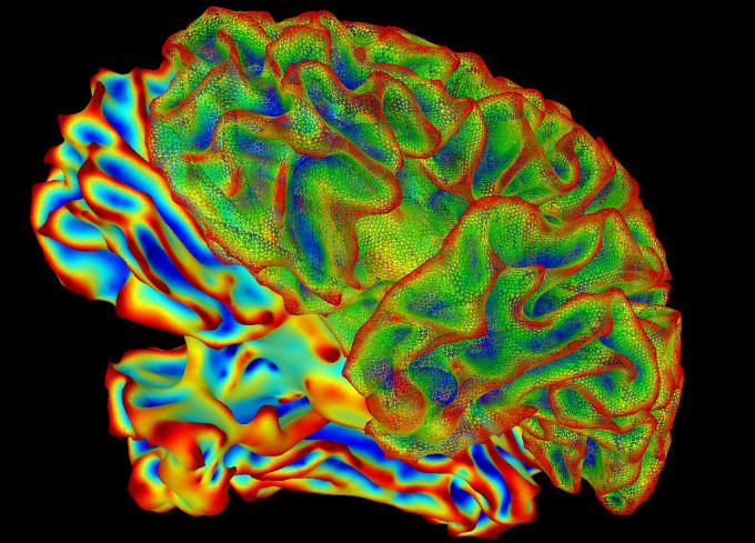Multi-color image (processed) of the whole brain generated by functional Magnetic Resonance Imaging. CREDIT: National Institute of Mental Health, National Institutes of Health.