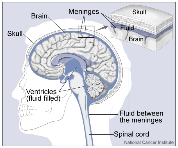 Brain diagram showing the ventricles that are lined with ependymal cells, where pediatric ependymoma can arise. CREDIT: Alan Hoofring, https://visualsonline.cancer.gov/details.cfm?imageid=4279.