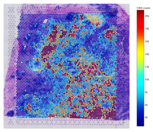 Visualization of gene expression heatmap on a Visium Spatial Gene Expression slide.