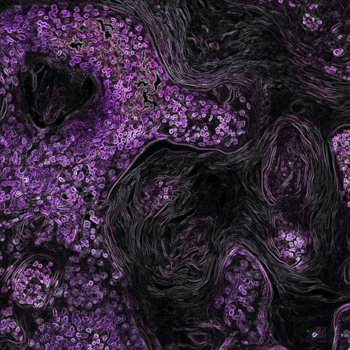 Kras-Driven Lung Cancer. Created by Eric Snyder, 2015. CREDIT: National Cancer Institute on Unsplash.