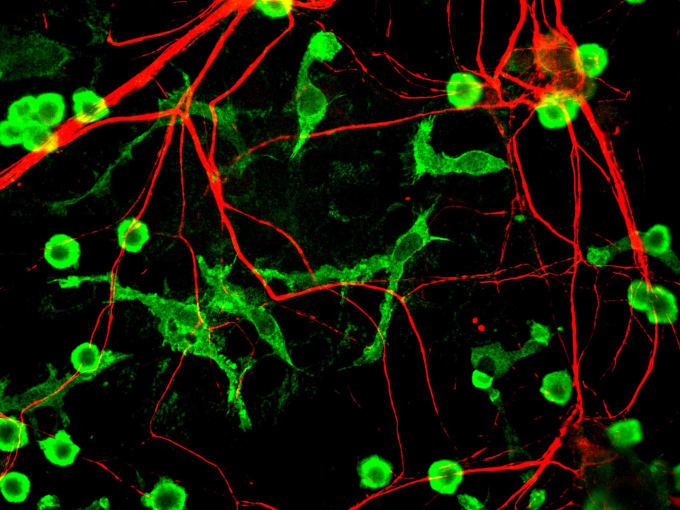 Rat microglia grown in tissue culture in green, along with nerve fiber processes shown in red. CREDIT: GerryShaw (CC BY-SA 3.0).