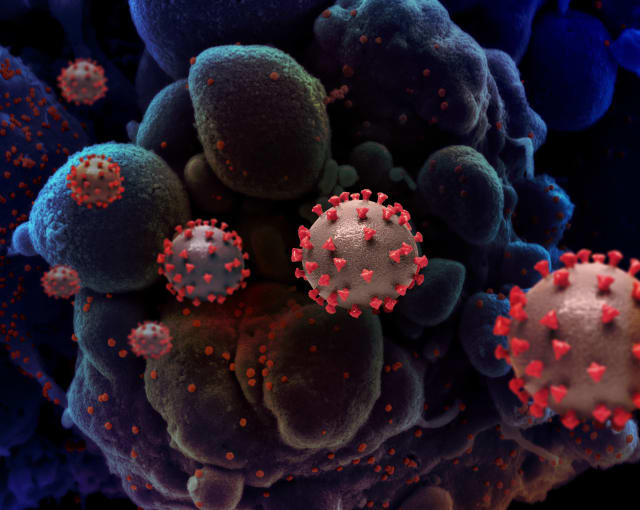 Creative rendition of SARS-COV-2 virus particles. Not to scale. CREDIT: National Institute of Allergy and Infectious Diseases, NIH.