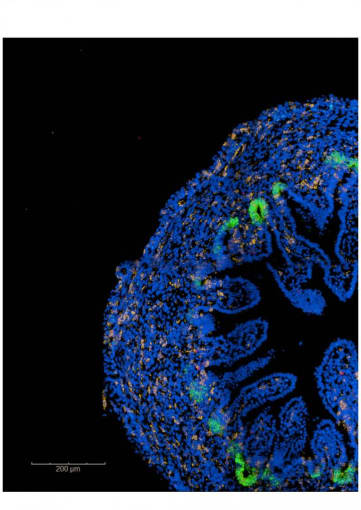 Emerging intestinal villi with green stem cells supporting their growth. CREDIT: Kenny Roberts & Sophie Pritchard, Wellcome Sanger Institute. 