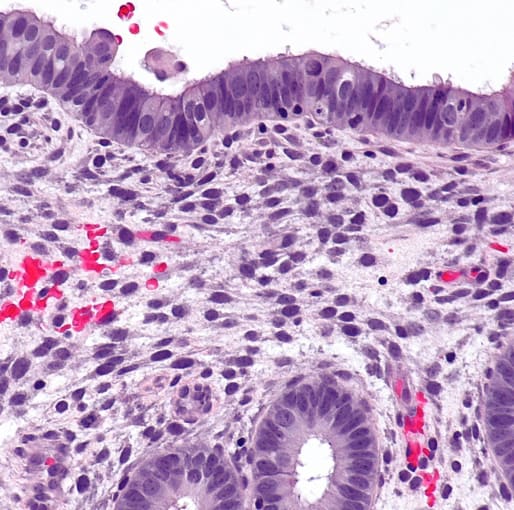 Micrograph of proliferative phase endometrium. H&E stain. CREDIT: Nephron - Own work. (CC BY-SA 3.0).