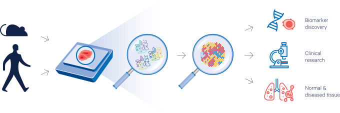 Figure 3. Fueling translational research. Spatial gene expression of intact FFPE tissue sections allows for biomarker discovery, performing retrospective and longitudinal studies, and comparisons of normal and diseased tissue.