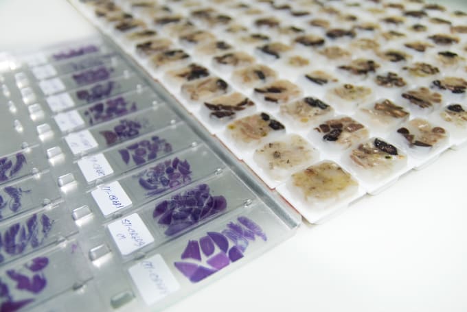 Figure 1. Histopathology slides and FFPE tissue blocks. Credit: MaXPdia, Getty Images.