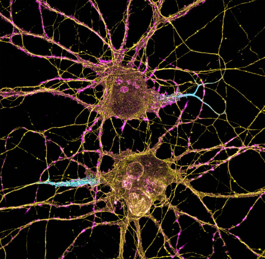 Neurons. Credit: Leterrier, NeuroCyto Lab, INP, Marseille, France