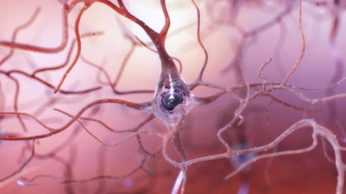 Image of a healthy neuron. Credit: National Institute on Aging, National Institutes of Health 