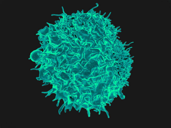 Colorized scanning electron micrograph of a T lymphocyte. Credit: National Institute of Allergy and Infectious Diseases, National Institutes of Health