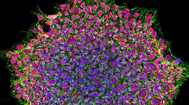Organoid