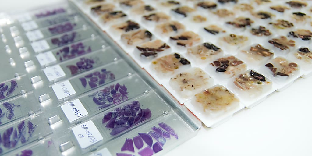 Histopathology slides and FFPE tissue blocks. Credit: MaXPdia, Getty Images.