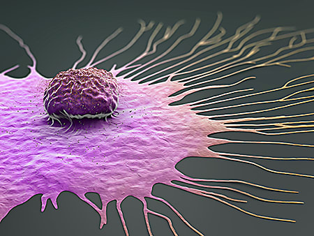 A breast cancer cell undergoing the process of expansion. Credit: The University of Alabama at Birmingham.