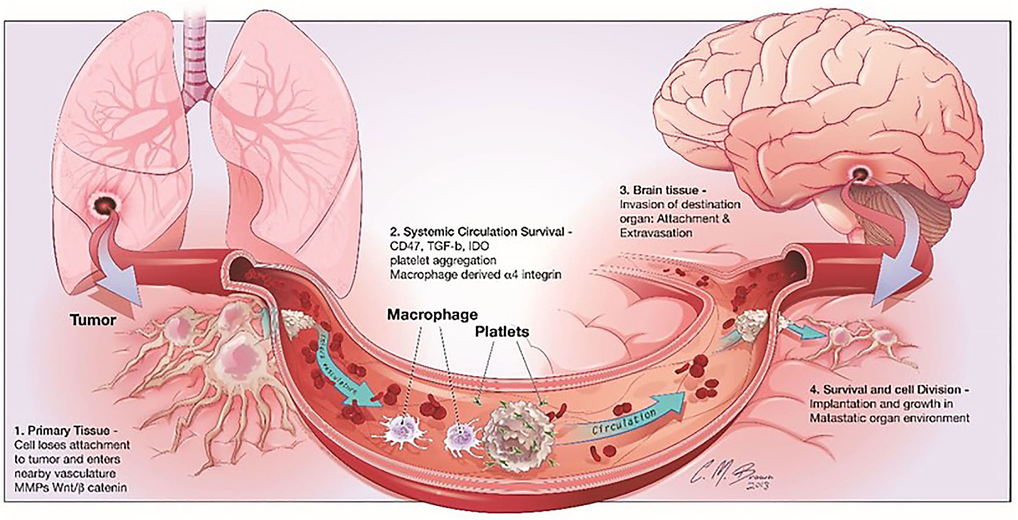 Steps involved in brain metastasis. Brain metastasis cascade involves four major steps: 1) Detachment of the metastatic cell from the primary cancer, 2) Survival in systemic circulation, 3) Invasion in the brain parenchyma, and 4) Survival in the CNS microenvironment. CREDIT: Luo L, et al. The immune microenvironment in brain metastases of non-small cell lung cancer. Front Oncol 11: 698844 (2021). (CC BY 4.0).