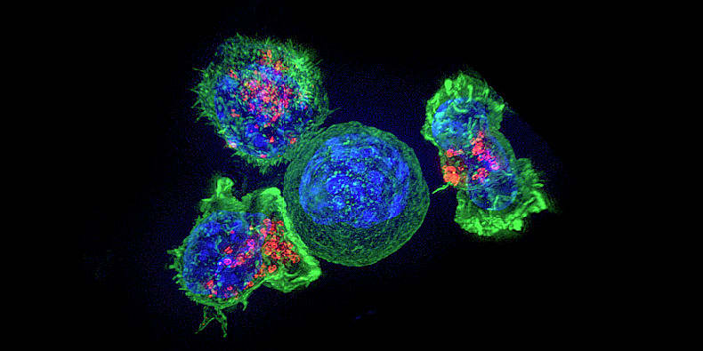 A group of killer T cells (green and red) surrounding a cancer cell (blue, center). CREDIT: National Institutes of Health.