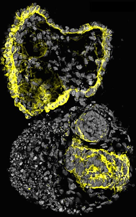 Human cystic kidney organoid developed by the McMahon lab at the USC Keck School of Medicine. (CREDIT: Cheng (Jack) Song/McMahon Lab)