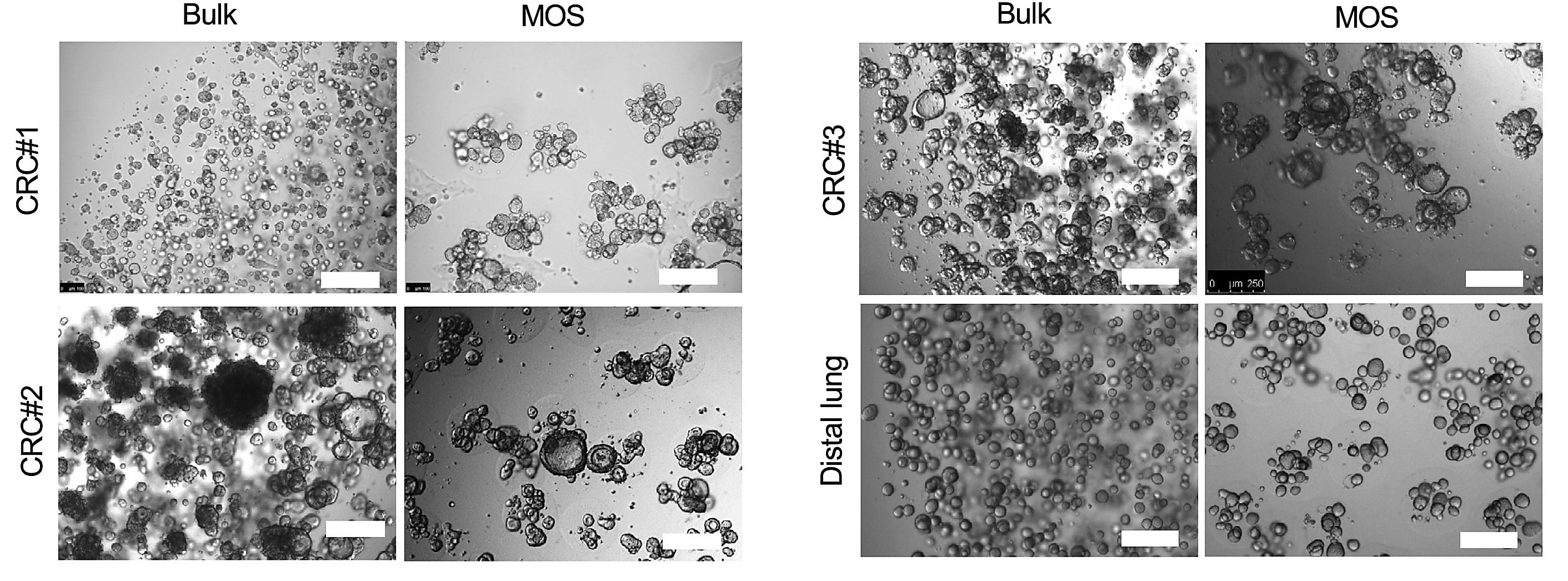Researchers used tumor samples from three colorectal cancer (CRC) patient tumor samples and a distal lung cell line to develop bulk organoid cultures and microorganospheres (MOS). CREDIT: Wang Z, et al. Stem Cell Reports 17: 959–1975 (2022) (12), (CC BY 4.0)