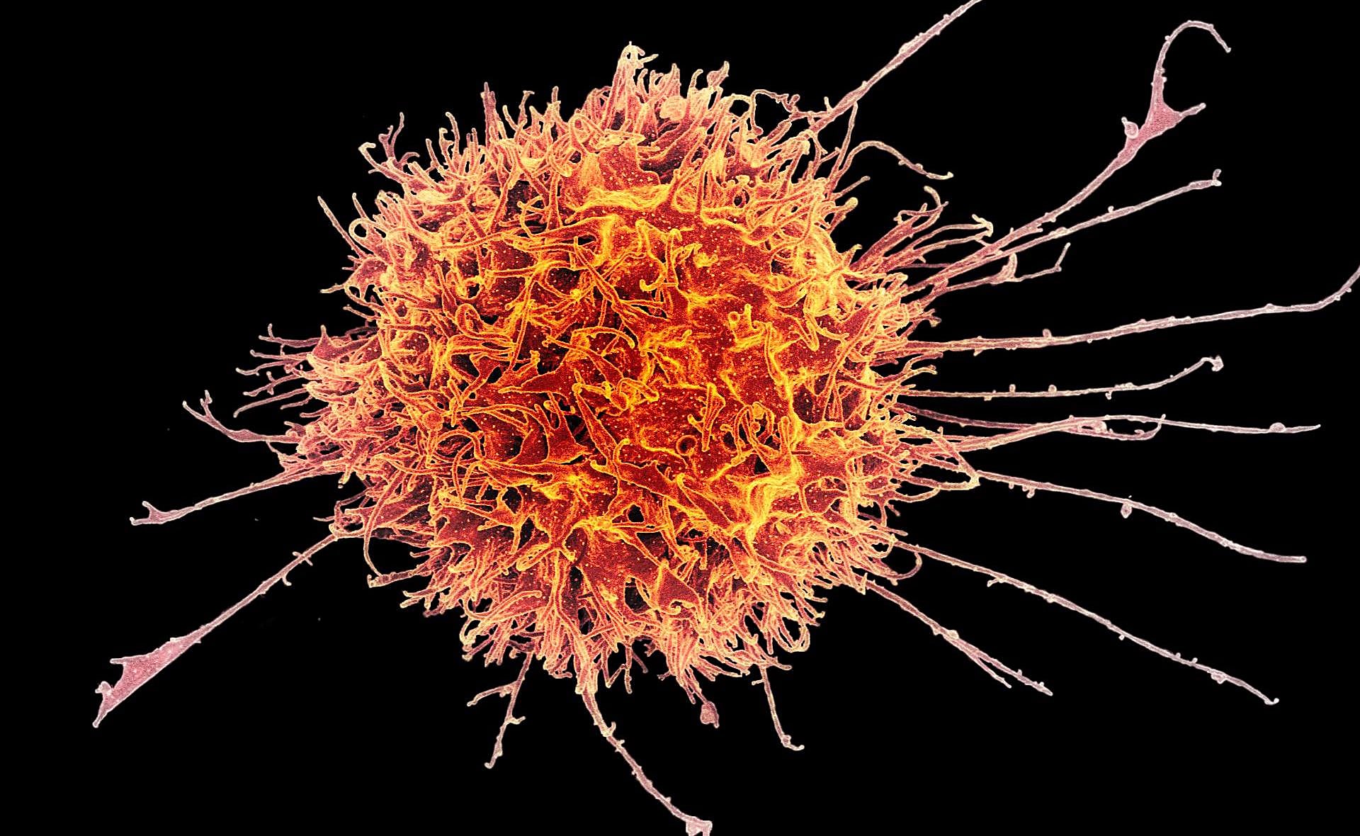 A Movement Rises To Guide Car T Cell Therapy Development With Single Cell Multiomics 10x Genomics