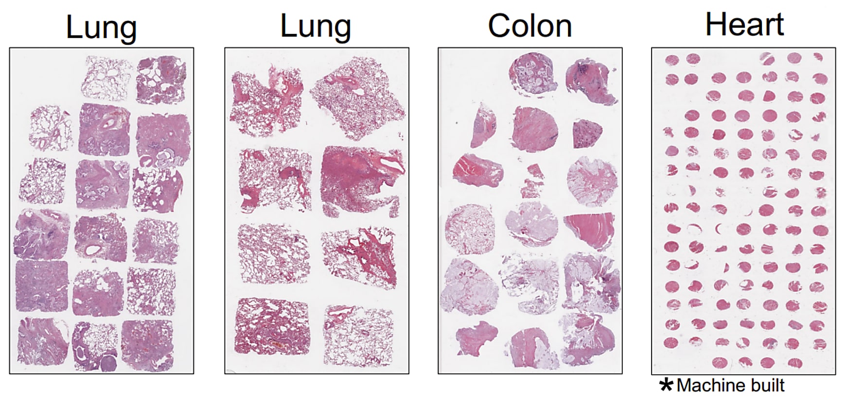 How TGen drastically reduced Xenium per-sample costs for large
