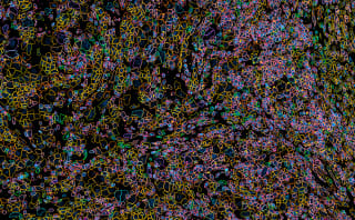 https://cdn.10xgenomics.com/image/upload/dpr_2.0,f_auto,q_auto,w_160/v1752863918/Xenium_protein_demo_screenshot_wnkxfi.png