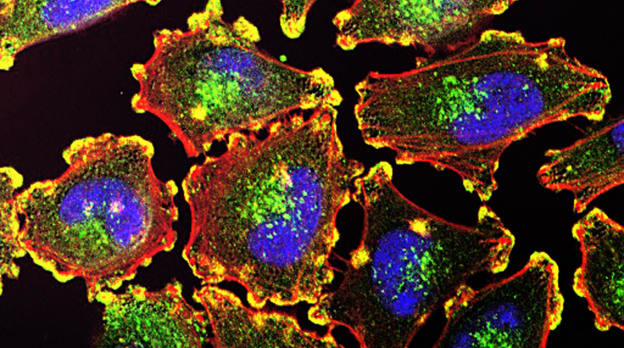 Adoptive cell therapy