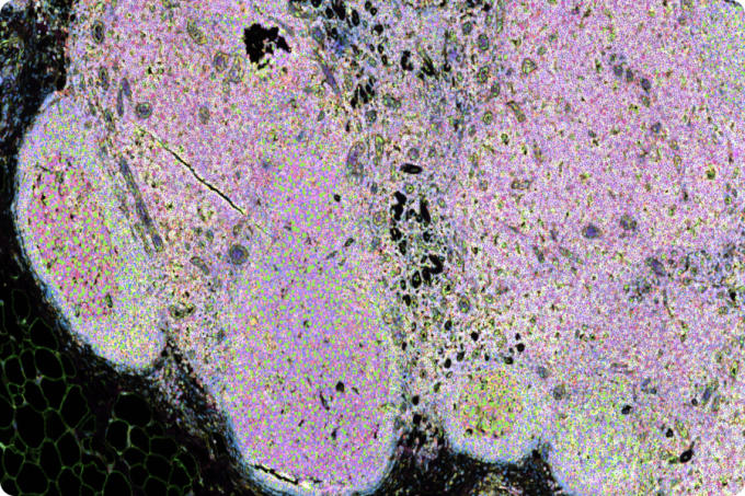 https://cdn.10xgenomics.com/image/upload/dpr_2.0,f_auto,q_auto,w_340/v1710890975/products/Xenium/predesigned-panels-xenium-prime-5k-human-pan-tissue.jpg