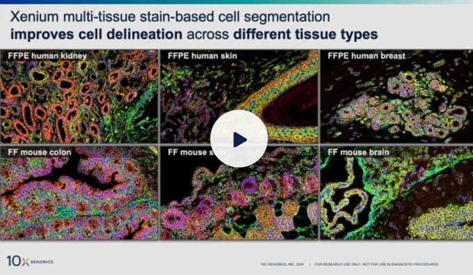 https://cdn.10xgenomics.com/image/upload/dpr_2.0,f_auto,q_auto,w_340/v1752024812/products/Xenium/ht-projection-tracing.png