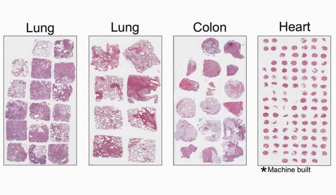 https://cdn.10xgenomics.com/image/upload/dpr_2.0,f_auto,q_auto,w_340/v1752024812/products/Xenium/tumor-microarrays-costs.png