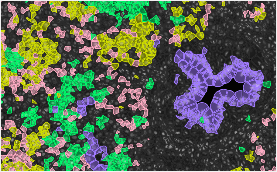 Xenium in situ gene expression screenshot