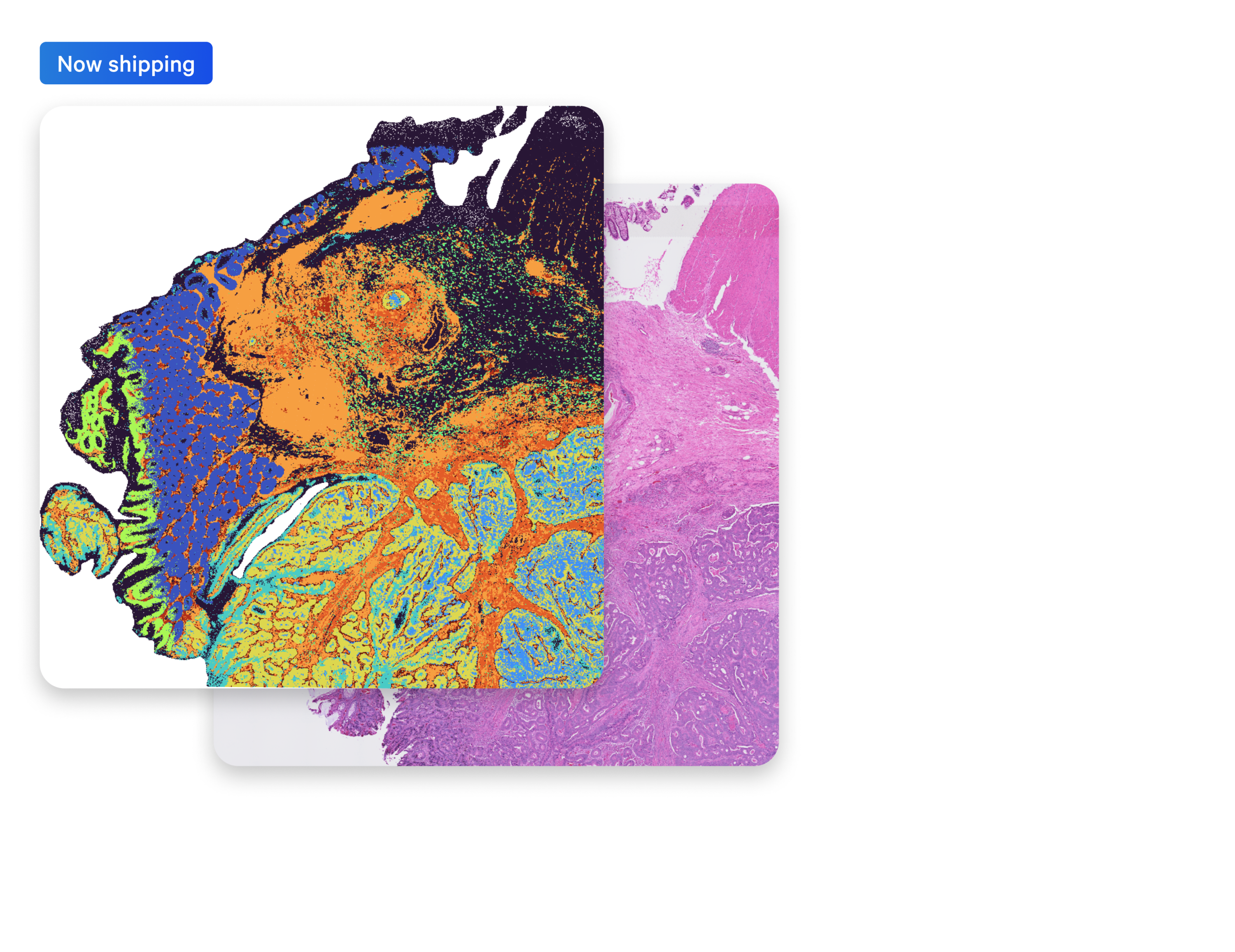 Overlay of Visium HD data and H&E image from the same tissue section