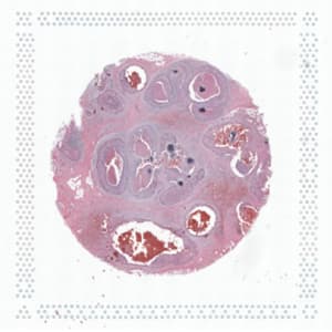 Stained tissue