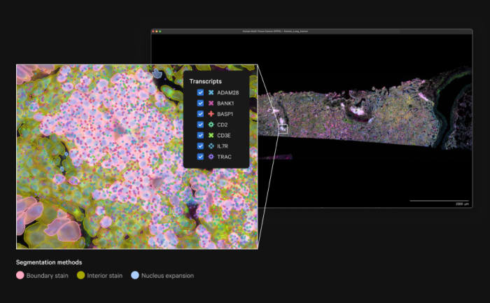 Xenium in situ gene expression screenshot