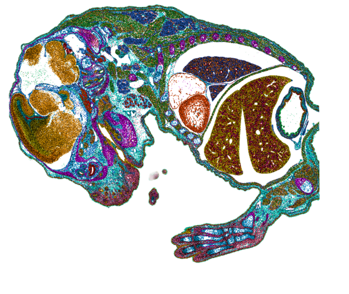 Visium HD 11mm Mouse Embryo