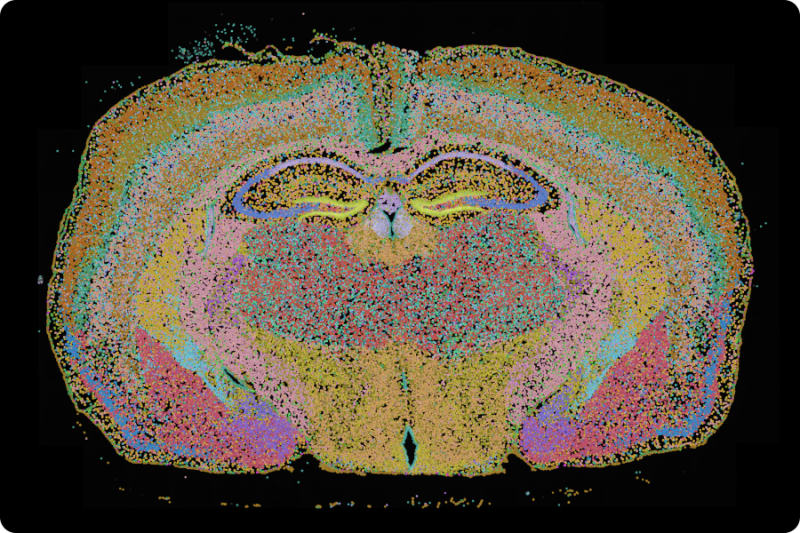 Mouse brain