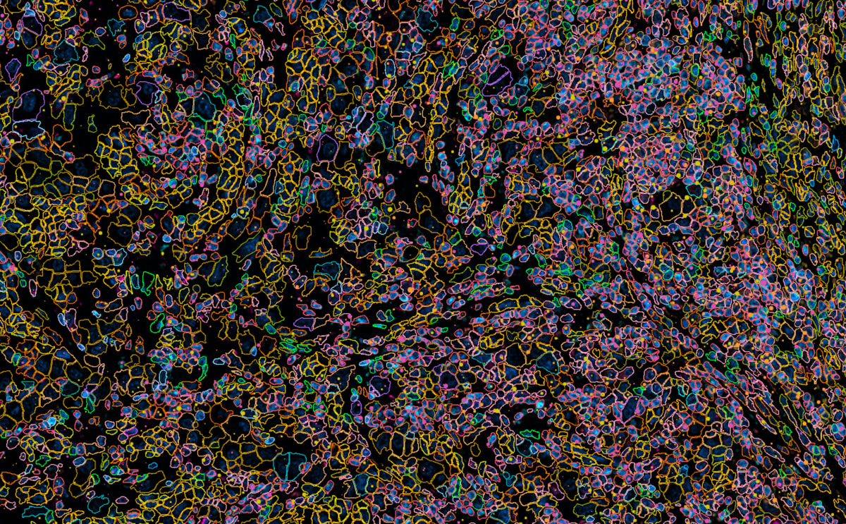 Screenshot of Xenium H&E image