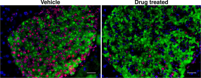 Left: In mice bred to develop type 1 diabetes, insulin-producing pancreatic beta cells (green) become senescent (red) before being attacked by the immune system. Right: A drug that eliminated senescent cells dramatically reduced type 1 diabetes risk in mice. CREDIT: Bhushan lab/UCSF