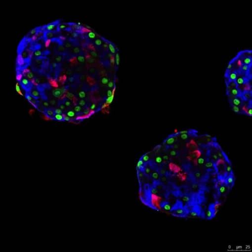 Pseudo-islets made up of human alpha cells. These cells produce glucagon (blue), but can learn to make insulin (red). The GFP protein (green) allows the origin of the cells to be traced, thus certifying their change of identity. CREDIT: © Pedro Herrera, UNIGEDiabetes relief in mice through glucose-sensing, insulin-secreting human alpha cells**