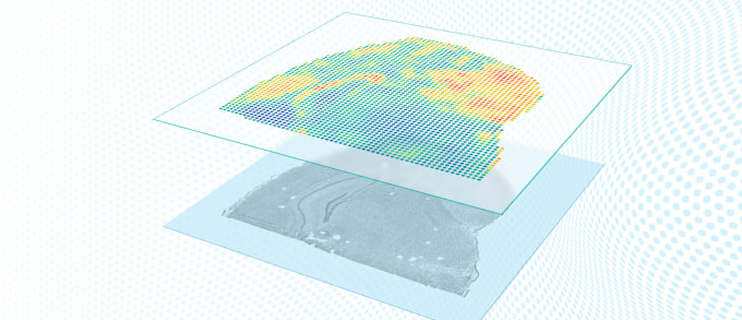 Visium Spatial Gene Expression Solution