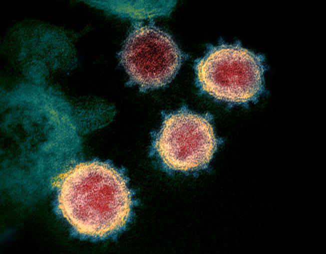 This transmission electron microscope image shows SARS-CoV-2, also known as 2019-nCoV. CREDIT: NIAID Rocky Mountain Laboratories (RML), U.S. NIH - https://www.niaid.nih.gov/news-events/novel-coronavirus-sarscov2-images 