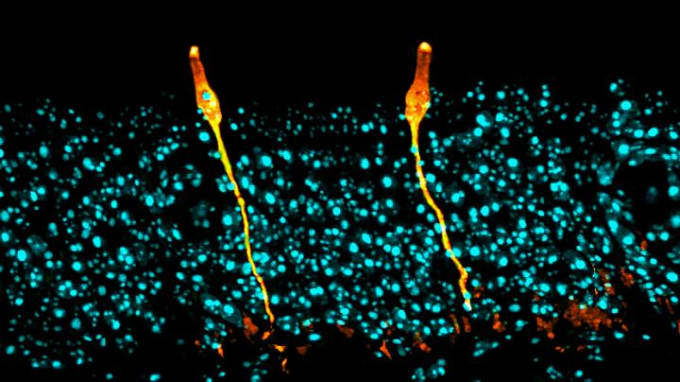Pulmonary ionocytes (orange) extend through neighboring epithelial cells in the upper respiratory tract of the mouse, to the surface of the epithelial lining. Cell nuclei in cyan. CREDIT: Montoro et al./Nature 2018