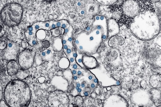 Transmission electron microscopic image of an isolate from the first U.S. case of COVID-19, formerly known as 2019-nCoV. The spherical viral particles, colorized blue, contain cross-sections through the viral genome, seen as black dots. CREDIT: CDC, Public Health Image Library (PHIL).
