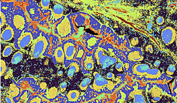 https://cdn.10xgenomics.com/image/upload/f_auto,q_auto/v1/products/Visium%20HD/Resources/intro-to-biology-in-hd