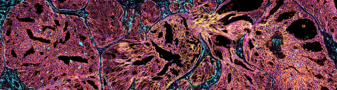 Atera In Situ - Featured Dataset