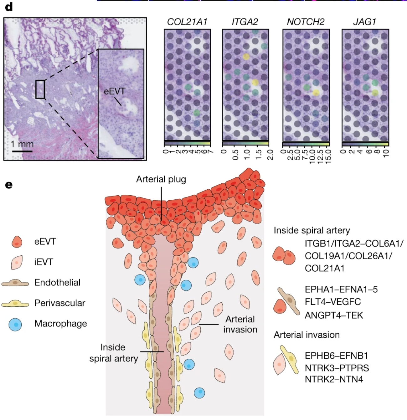 Figure 5d,e from Arutyunyan et al. d. Overview of spatial locations of invading trophoblast cell states in Visium spatial transcriptomics data of a representative section of donor P13 tissue. The position of the Capture Area is indicated with an arrow in Extended Data Fig. 1d. Spot color indicates cell state densities computed by cell2location as the number of cells of a given cell state in a Visium spot. e. Schematic representation of the spiral arteries in the first trimester of human pregnancy, highlighting the novel interactions between perivascular (PV)–iEVT, endothelial–eEVT, and eEVT–eEVT. Credit: Arutyunyan A, et al. Spatial multiomics map of trophoblast development in early pregnancy. Nature 616: 143–151 (2023). doi: 10.1038/s41586-023-05869-0. (CC BY 4.0).
