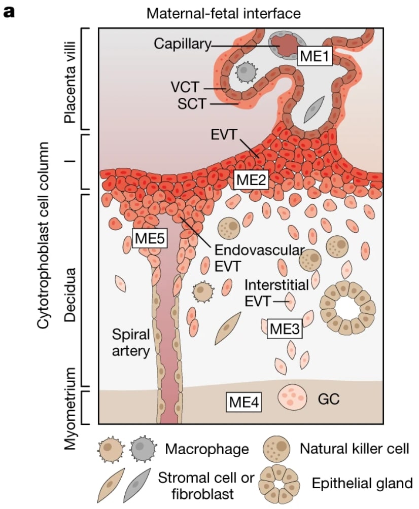 Figure 1a from Arutyunyan et al. Illustration of the maternal–fetal interface. Extravillous trophoblast (EVT) cells are shown infiltrating the maternal decidua and spiral artery. Credit: Arutyunyan A, et al. Spatial multiomics map of trophoblast development in early pregnancy. Nature 616: 143–151 (2023). doi: 10.1038/s41586-023-05869-0. (CC BY 4.0).
