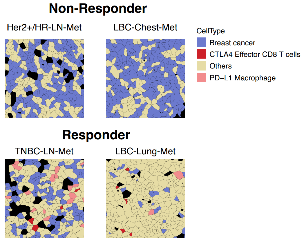 Figure 8. Cellular colocalization reveals responder-specific immune cell interactions with cancer cells. Xenium analysis of various breast cancer tissues show that specific immune cell types (red, pink) only colocalize with tumor cells (blue) in patients that responded to immunotherapy treatment. Image adapted from Figure 5C of Wang et al. 2024. (CC BY 4.0).