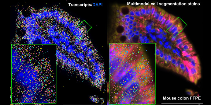 Figure 3. FFPE mouse colon analyzed using the Xenium Prime 5K assay with multimodal cell segmentation.
