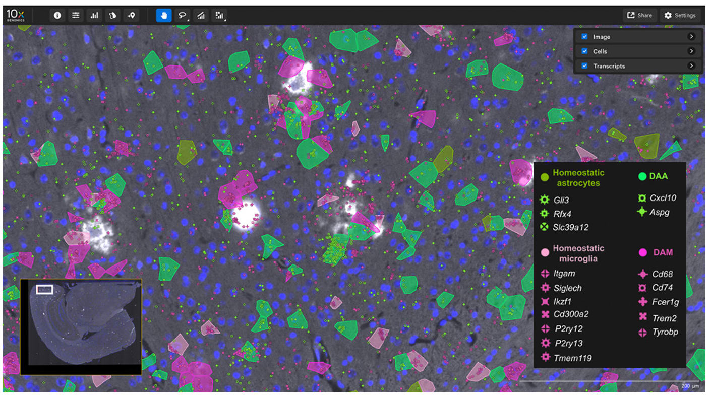 Figure 10. Brain tissue analyzed with both RNA and IF from a mouse model of Alzheimer’s disease. IF of amyloid plaques (white) surrounded by homeostatic and damage-associated astrocytes and microglia (shades of green and pink, respectively). Data taken from the Application Note, “Exploring Alzheimer’s-like pathology at subcellular resolution using Xenium In Situ.”