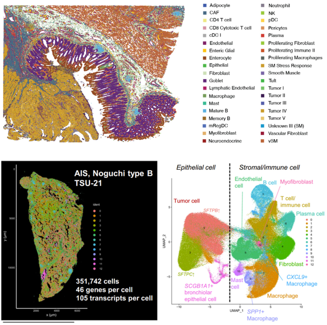 Figure 4. In-depth characterization of cell types using spatial transcriptomics tools. A. Sequencing-based spatial transcriptomics analysis of FFPE human colorectal cancer using Visium HD Spatial Gene Expression. Image adapted from Figure 3 of Oliveira et al. 2024 (1) (CC BY 4.0). B. Imaging-based spatial transcriptomics analysis of fresh frozen human lung cancer using the Xenium In Situ platform. Image adapted from Figure 6I of Haga et al. 2023 (2) (CC BY 4.0).