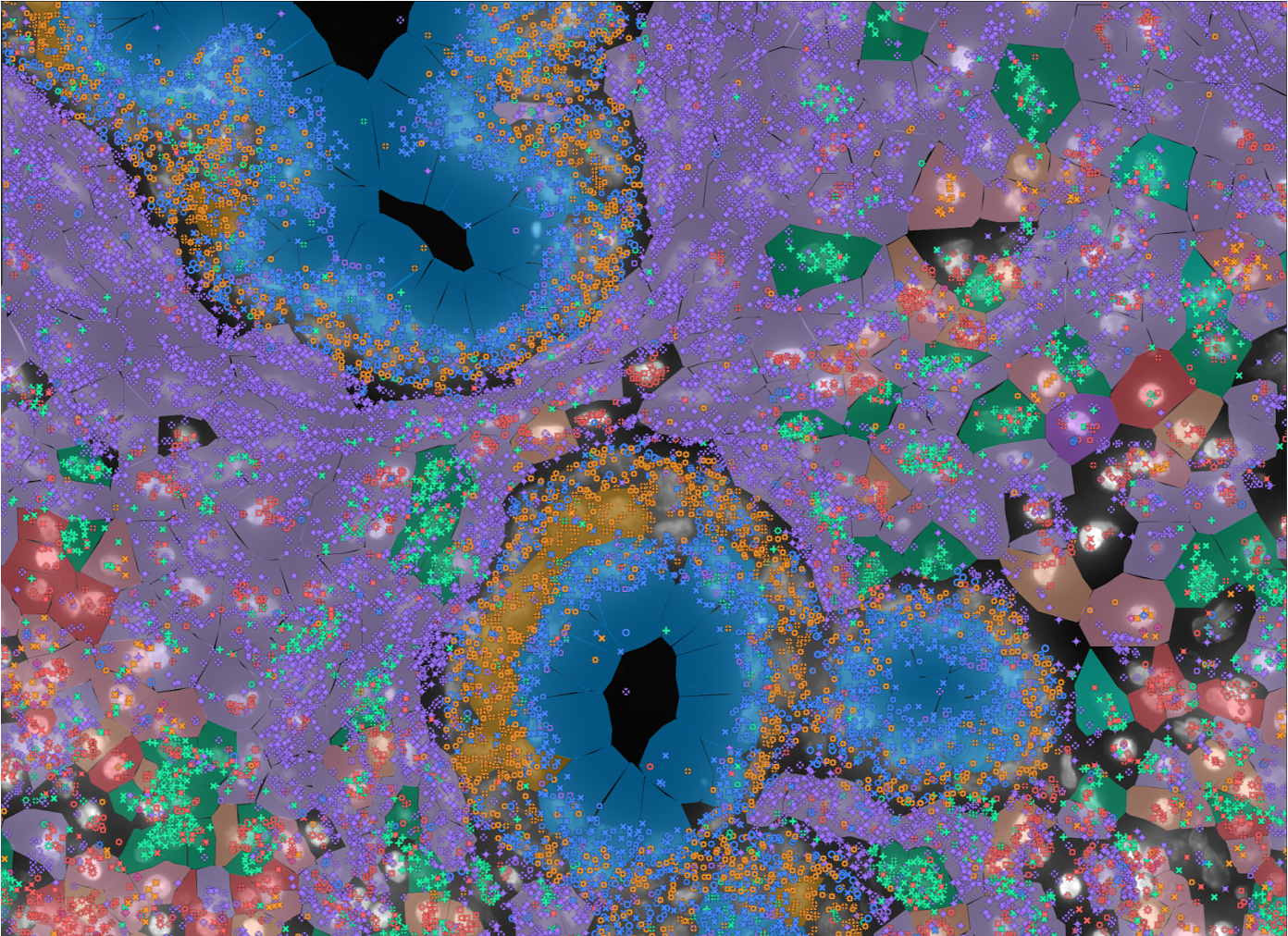 Tissue sample analyzed using the Xenium platform