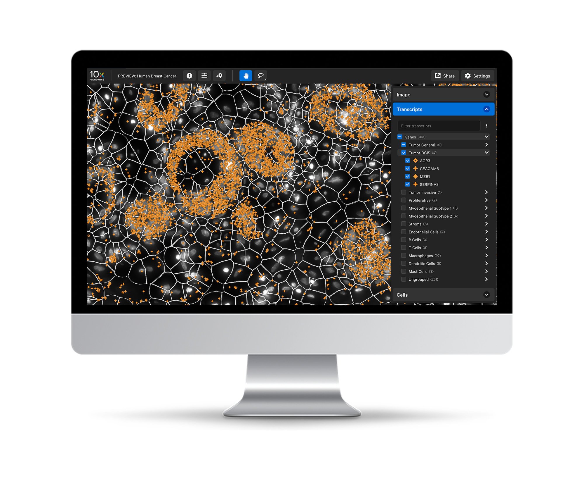 Xenium In Situ - 10x Genomics